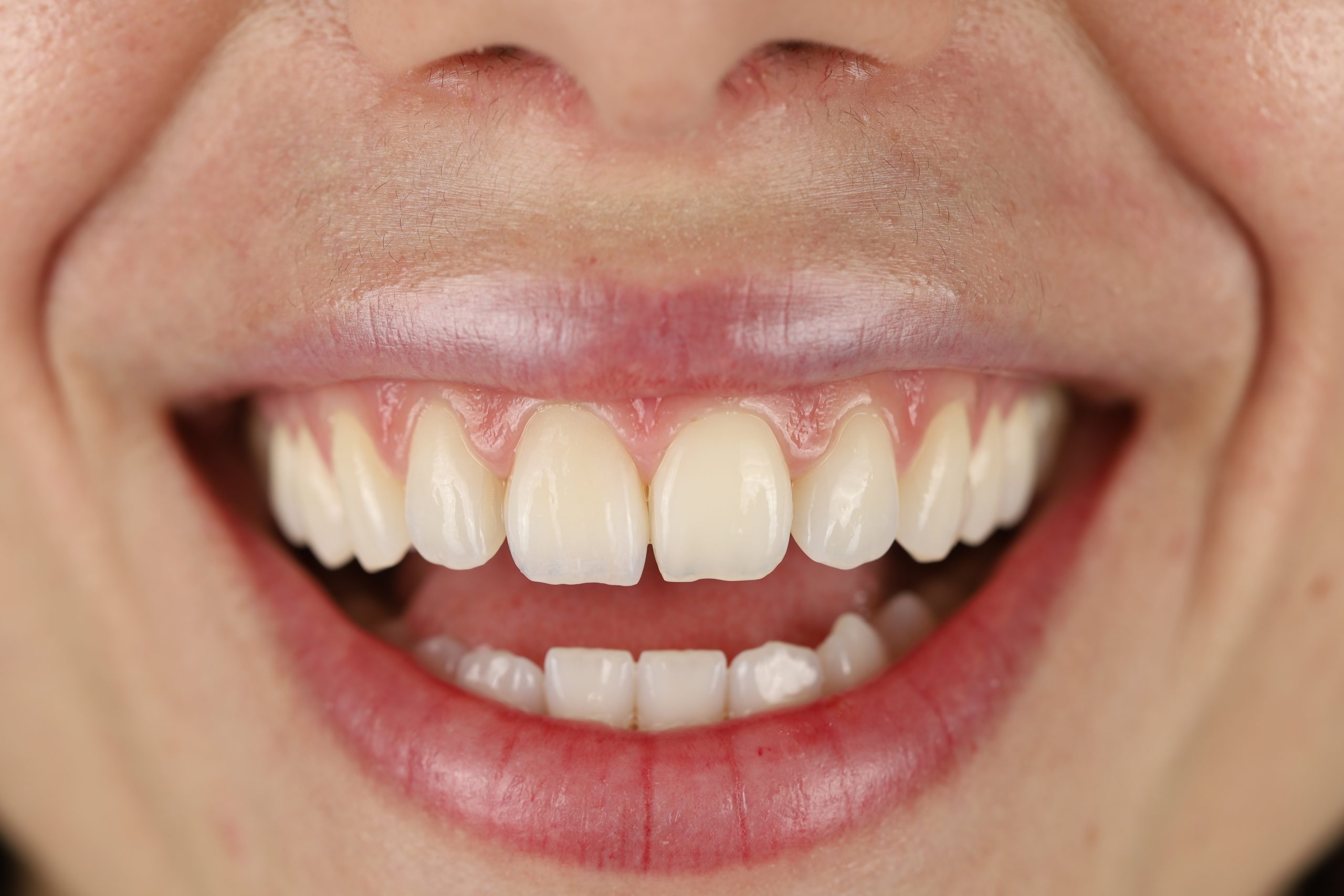 https://clinicadentalreinavictoria.com/wp-content/uploads/2026/09/estetica-dental-scaled.jpg